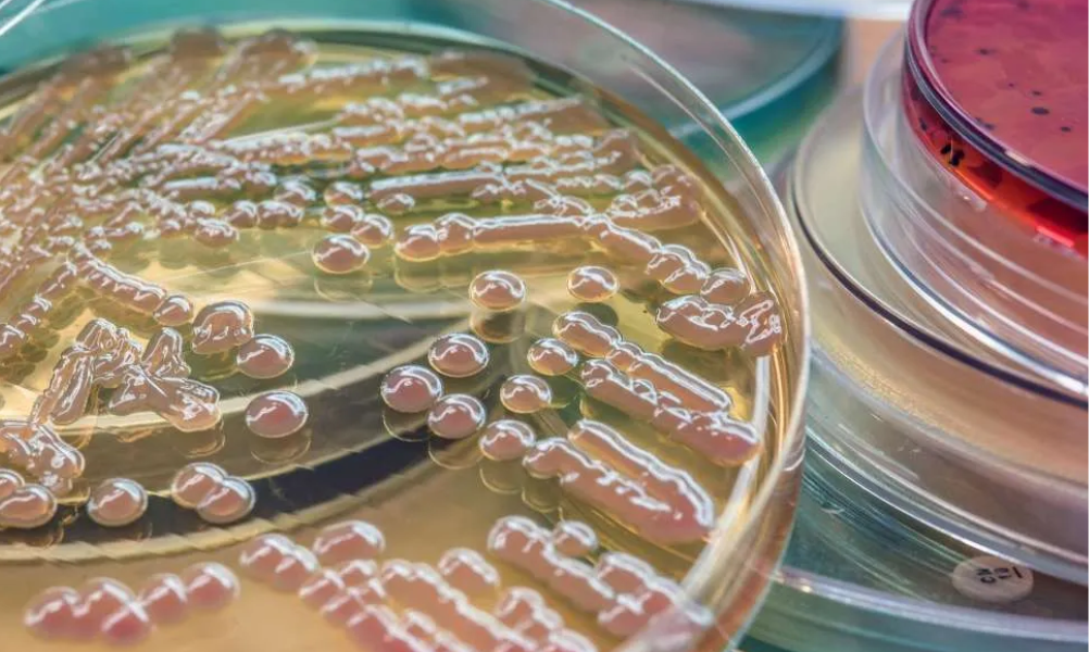challenge_test_listeria